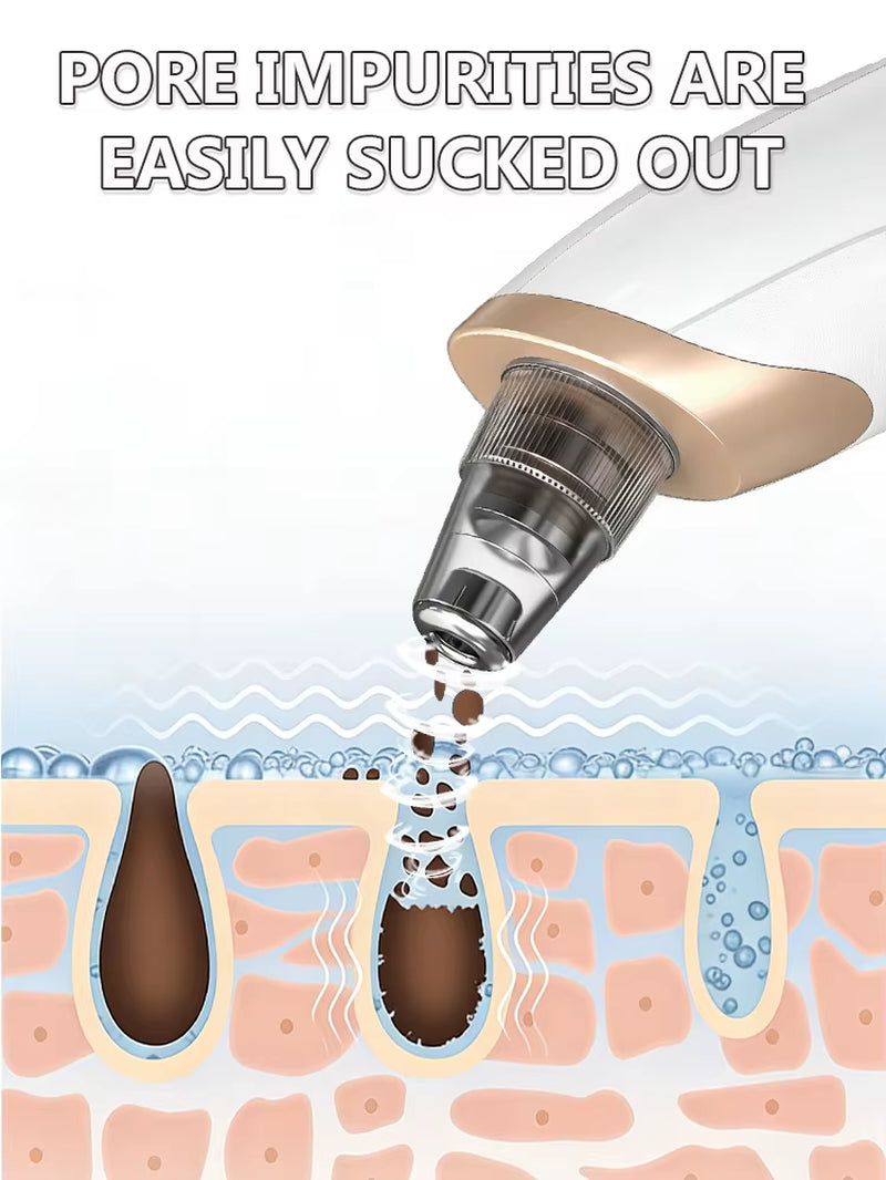 2025 New Upgrade Nose Blackhead Remover Pimples and Blackheads Vacuum from the Face Cleaner Tool
