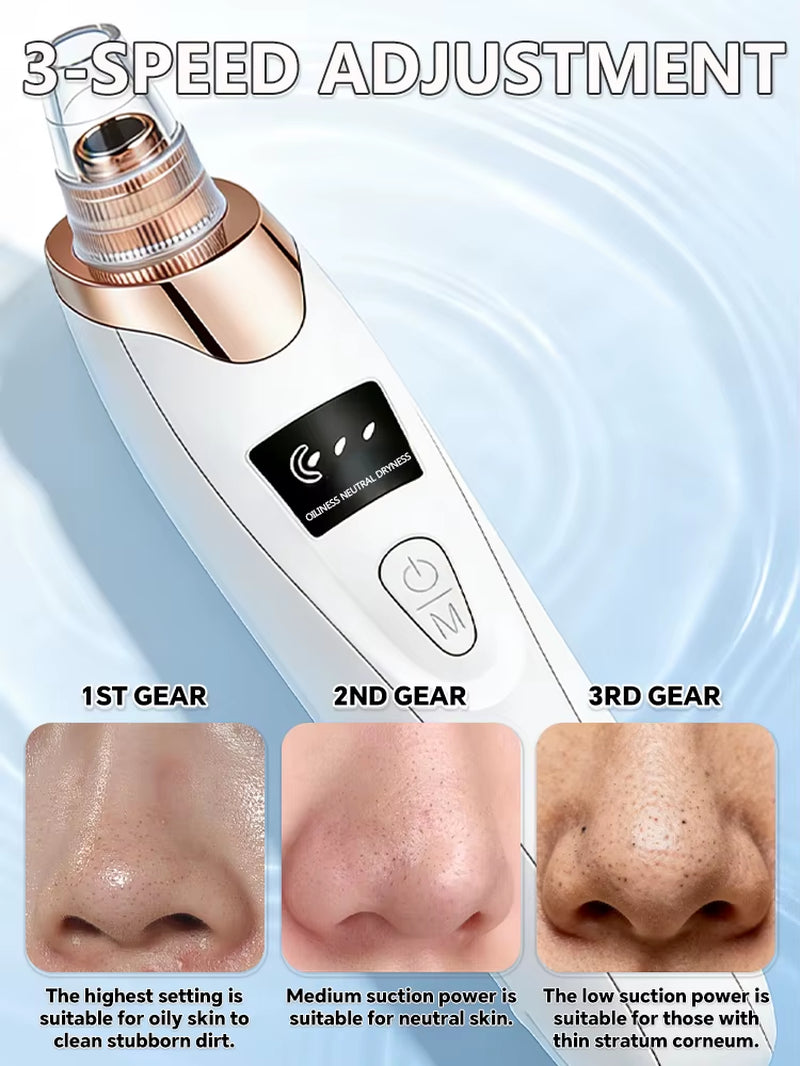 2025 New Upgrade Nose Blackhead Remover Pimples and Blackheads Vacuum from the Face Cleaner Tool