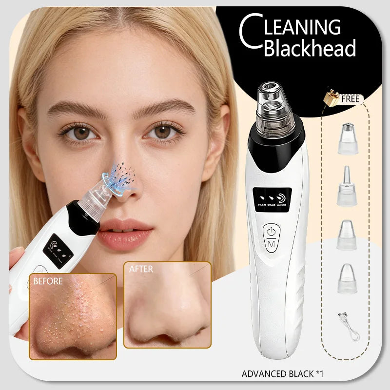 2025 New Upgrade Nose Blackhead Remover Pimples and Blackheads Vacuum from the Face Cleaner Tool