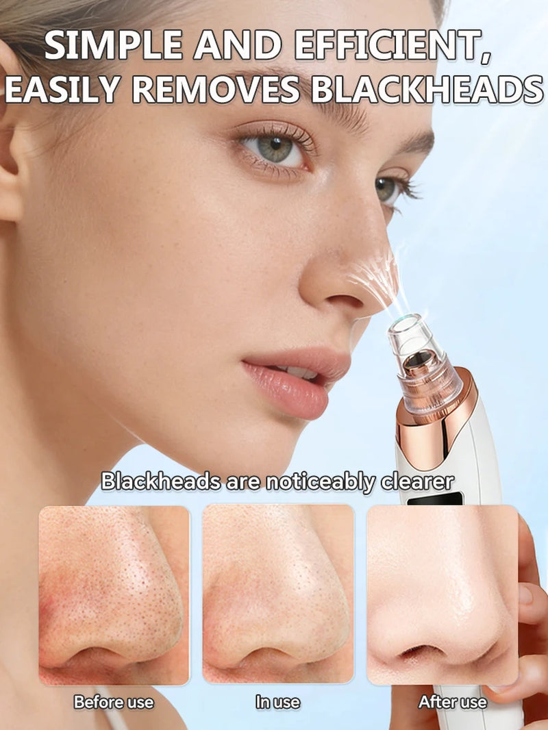 2025 New Upgrade Nose Blackhead Remover Pimples and Blackheads Vacuum from the Face Cleaner Tool